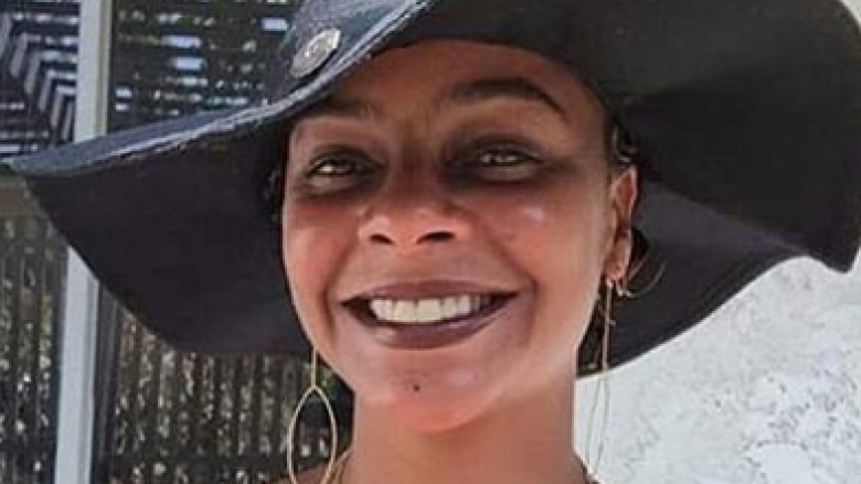 Lisa Turtle Is Sadly Unrecognizable Now